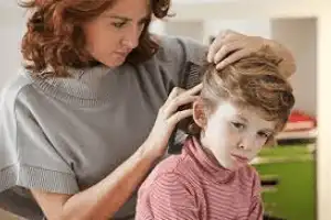 piojos y liendres-Remedios caseros para el cuidado del cabello-cabello maltratado-mascarillas-aloe vera-shampoo