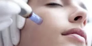 tratamiento-microneedling-maquillaje permanente-porcelana-curso-piel